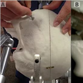 Connected neurotechnology devices demonstrating interoperability.